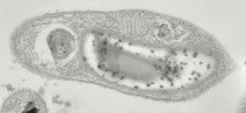 Ученые ТГУ описали бактерию, «застывшую» во времени, и нашли её родственника